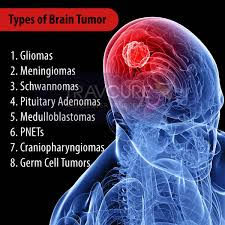 Brain & Spine Tumors - Dr Prem Pillay